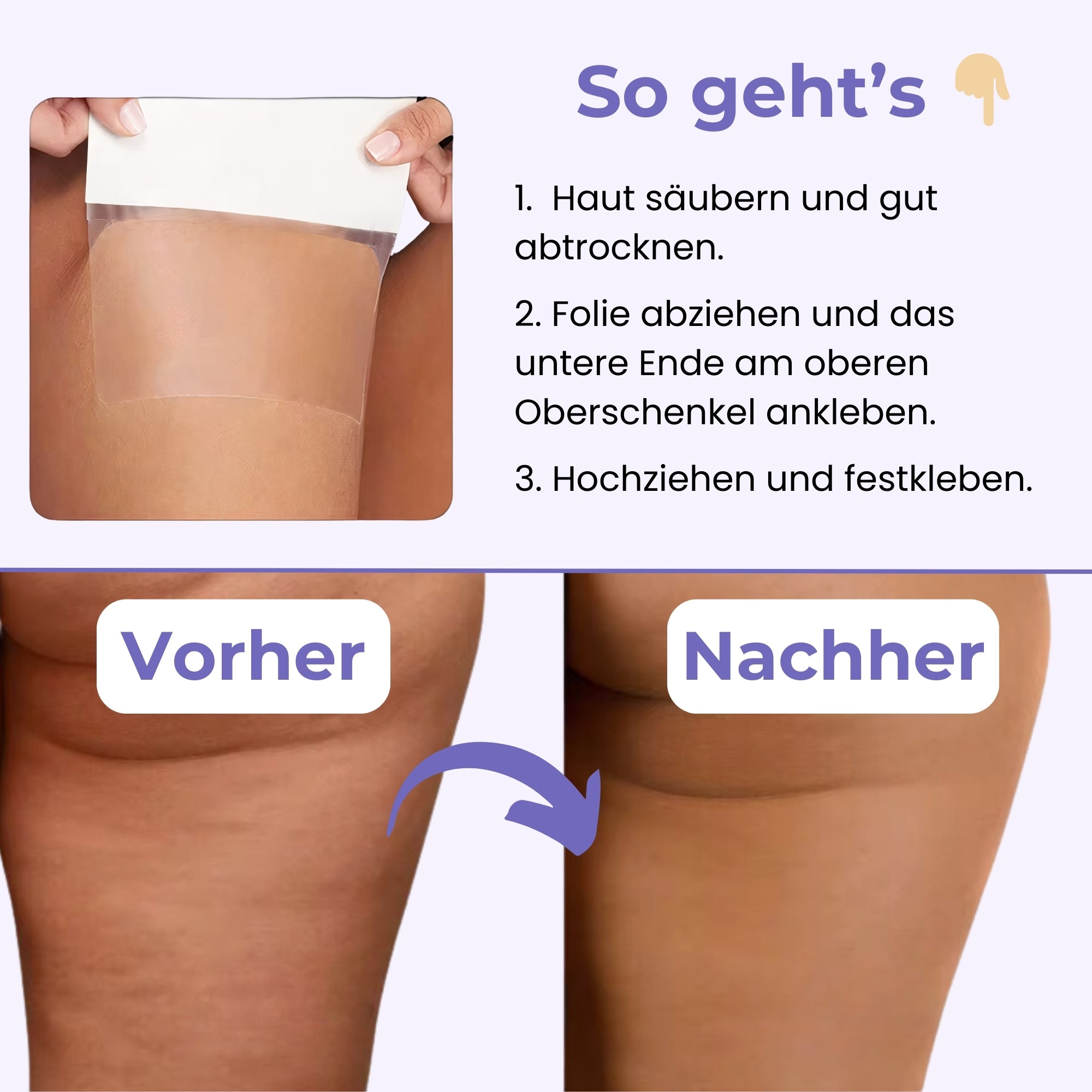 Cellu Patches | Verstecke Cellulite in Sekunden